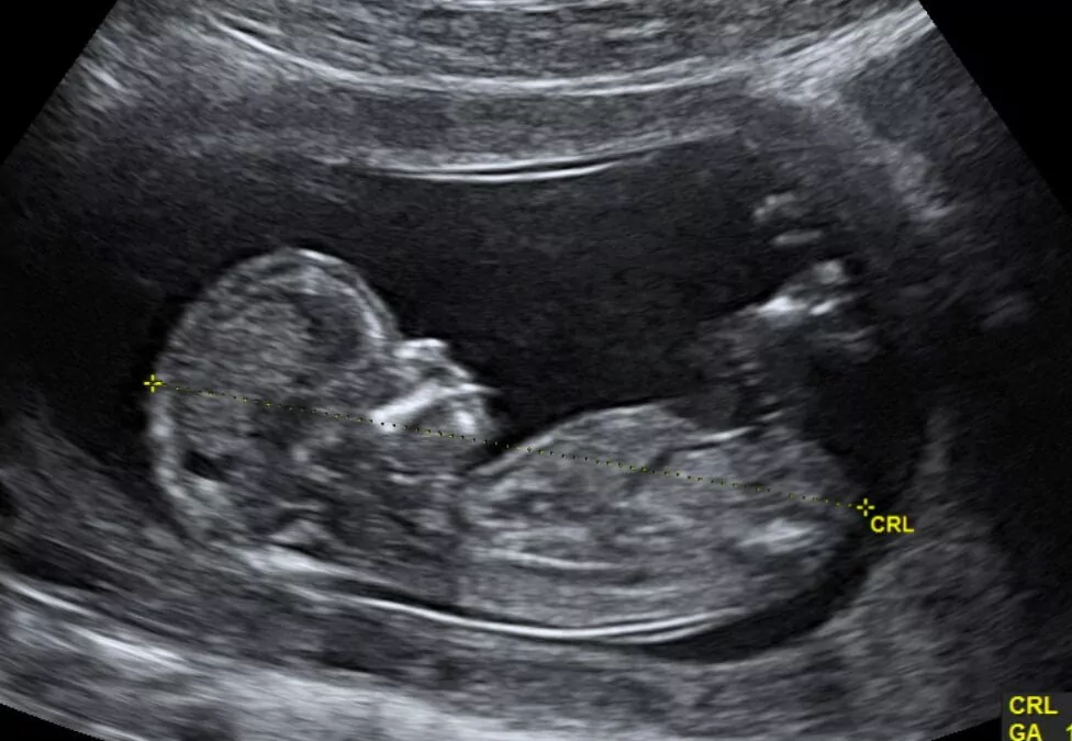 What’s Next for IVHCare:  More Work Than Ever Before